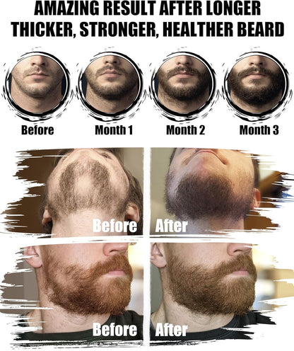 Beard Kit for Men Grooming & Care